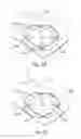 Fig. 03 - Microelectromechanical gyroscopes and related apparatus and methods