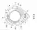 Fig. 04 - Accelerating handle assembly for electric vehicle