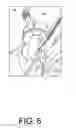Fig. 07 - Ground anchor strap puller, tensioner and cutter