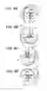 Fig. 08 - Conveying apparatus for dipping workpieces into a treatment bath