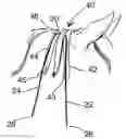 Fig. 01 - HORSE HAIR BRAIDING DEVICE AND METHOD