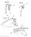 Fig. 05 - HORSE HAIR BRAIDING DEVICE AND METHOD