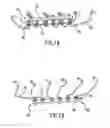 Fig. 02 - Common rail system with leak containment and detection