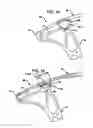 Fig. 12 - Archery bows and archery bow components I