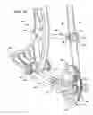 Fig. 17 - Archery bows and archery bow components I