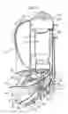 Fig. 14 - Drug dispenser