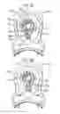 Fig. 19 - Drug dispenser