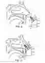 Fig. 03 - Nasal devices