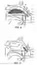 Fig. 04 - Nasal devices