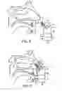 Fig. 05 - Nasal devices