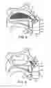 Fig. 06 - Nasal devices