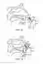 Fig. 07 - Nasal devices