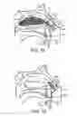 Fig. 08 - Nasal devices
