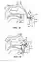 Fig. 09 - Nasal devices