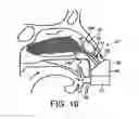 Fig. 12 - Nasal devices