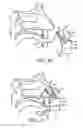 Fig. 13 - Nasal devices