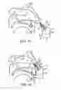 Fig. 15 - Nasal devices