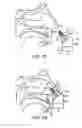 Fig. 17 - Nasal devices