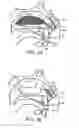 Fig. 18 - Nasal devices