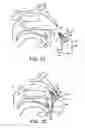 Fig. 19 - Nasal devices