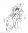 Fig. 30 - Nasal devices