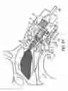 Fig. 37 - Nasal devices