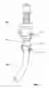 Fig. 02 - Ventilator Coupling Lock for Tracheostomy Tube