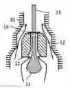 Fig. 01 - High Range Flow Valve