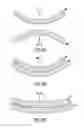 Fig. 03 - Method for molecular adhesion bonding with compensation for radial misalignment