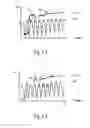 Fig. 04 - Methods and devices for determination of gas-kick parametrs and prevention of well explosion
