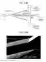 Fig. 25 - MICROFLUIDIC DEVICE FOR CELL SEPARATION AND USES THEREOF