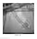 Fig. 07 - Transmission electron microscope grid and method for making same