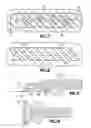 Fig. 05 - Spinal cord stimulation paddle lead and method of making the same