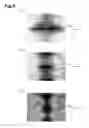 Fig. 07 - Laser beam working machine