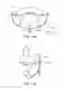 Fig. 11 - Device for preventing entanglement of welding wire