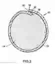 Fig. 03 - Flux Cored Preforms for Brazing