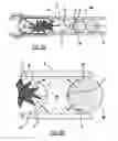 Fig. 07 - High Seal Retractor Pretensioner Piston