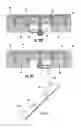 Fig. 15 - Patient single surface system