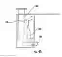 Fig. 25 - Patient single surface system