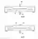 Fig. 45 - Patient single surface system
