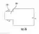 Fig. 46 - Patient single surface system