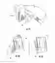 Fig. 49 - Patient single surface system