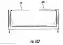 Fig. 69 - Patient single surface system