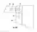 Fig. 70 - Patient single surface system