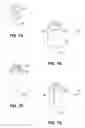 Fig. 06 - System for radiation sterilization of medical devices using a package having modifier sections