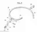Fig. 03 - Tree stand hoist system