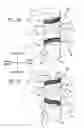 Fig. 08 - Full bore compression sealing method