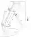 Fig. 04 - Vehicle front wheel pivot lock