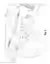 Fig. 07 - Vehicle front wheel pivot lock