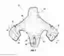 Fig. 05 - Protection device including an inflatable member